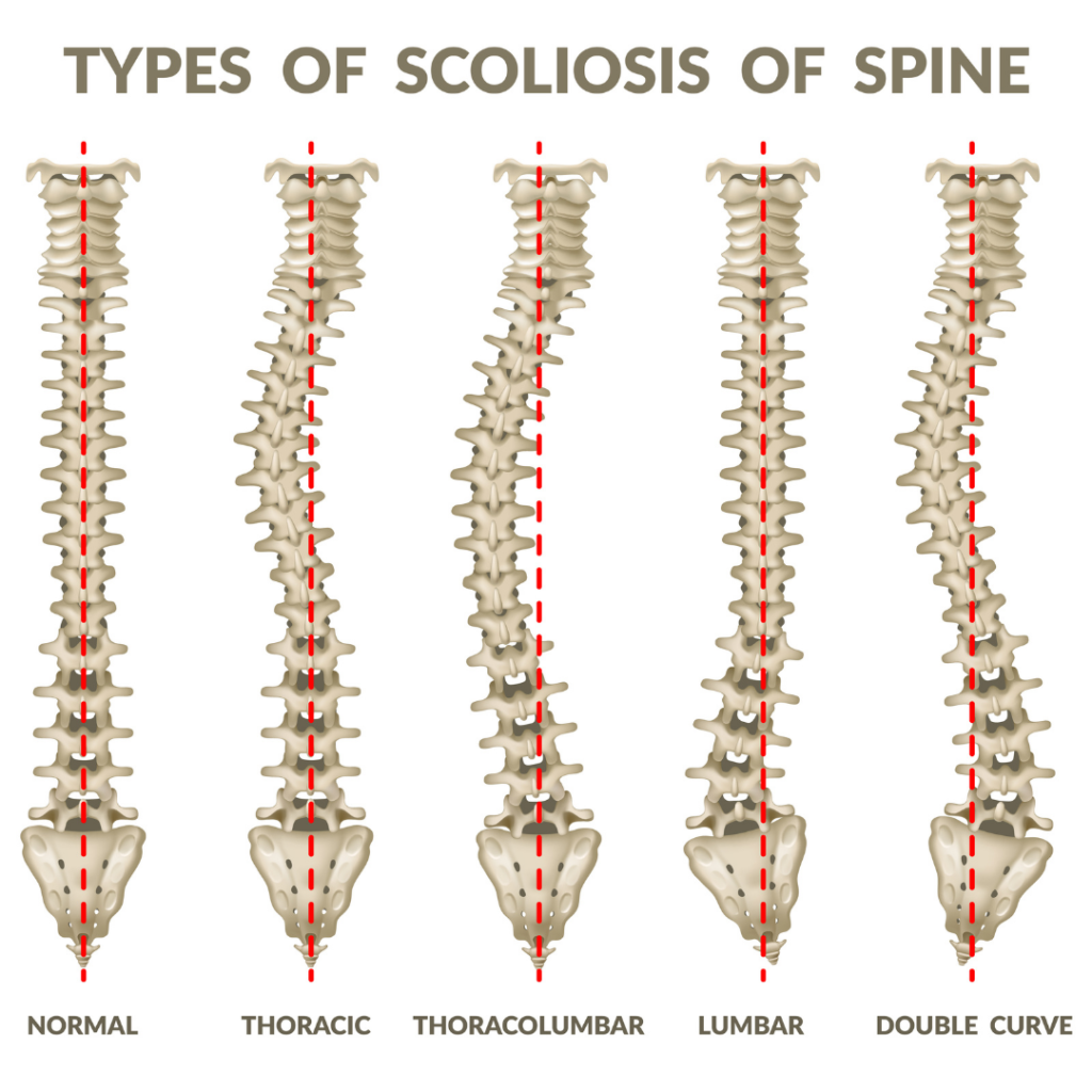 Spine surgery.